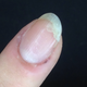 Illustration for article titled How to Fix a Torn Nail